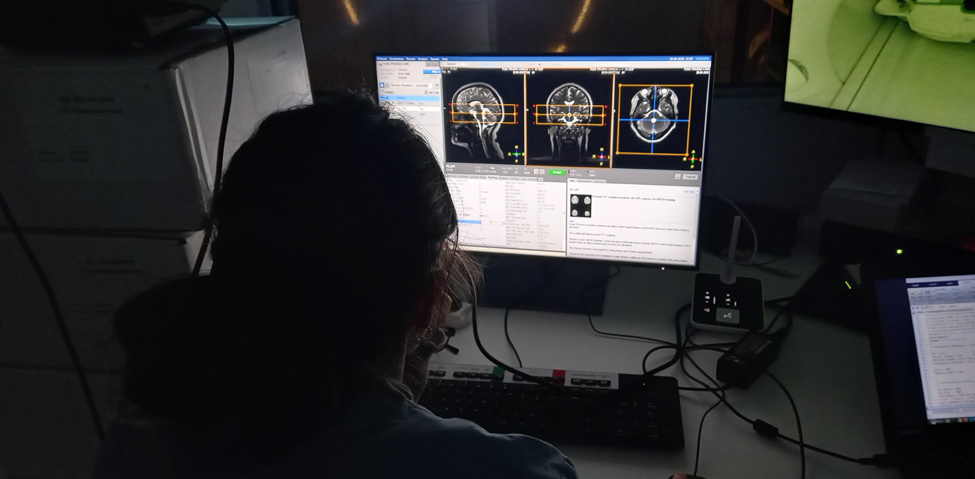 resonador cerebro