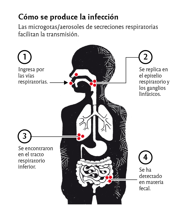 Grafico Bocavirus ninos